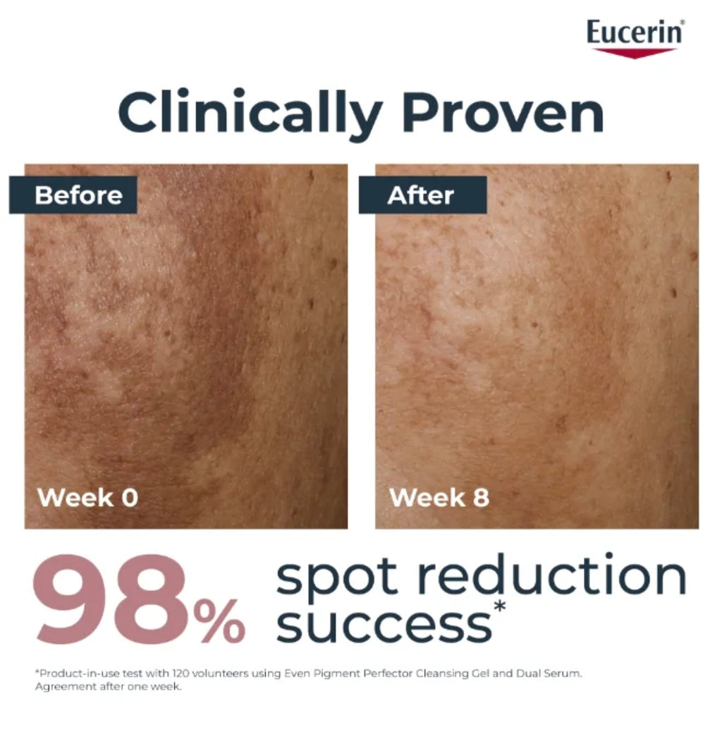 Eucerin Even Pigment Perfector Dual Serum – 30 ml
