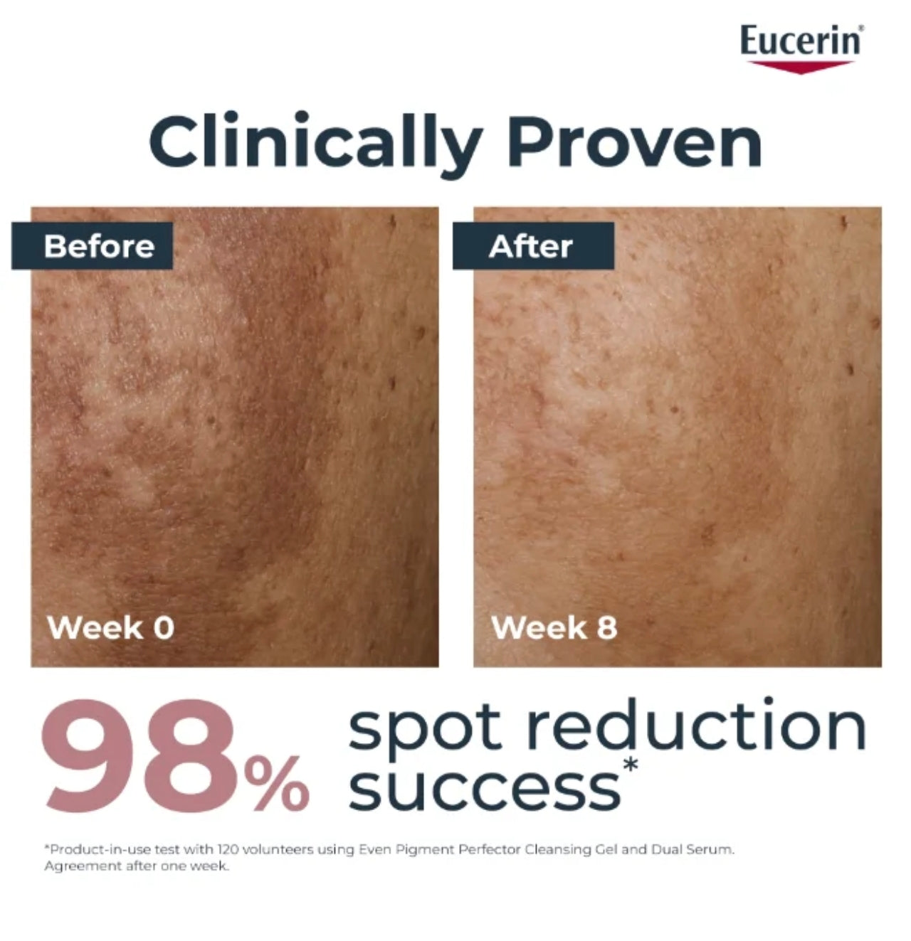 Eucerin Even Pigment Perfector Dual Serum – 30 ml